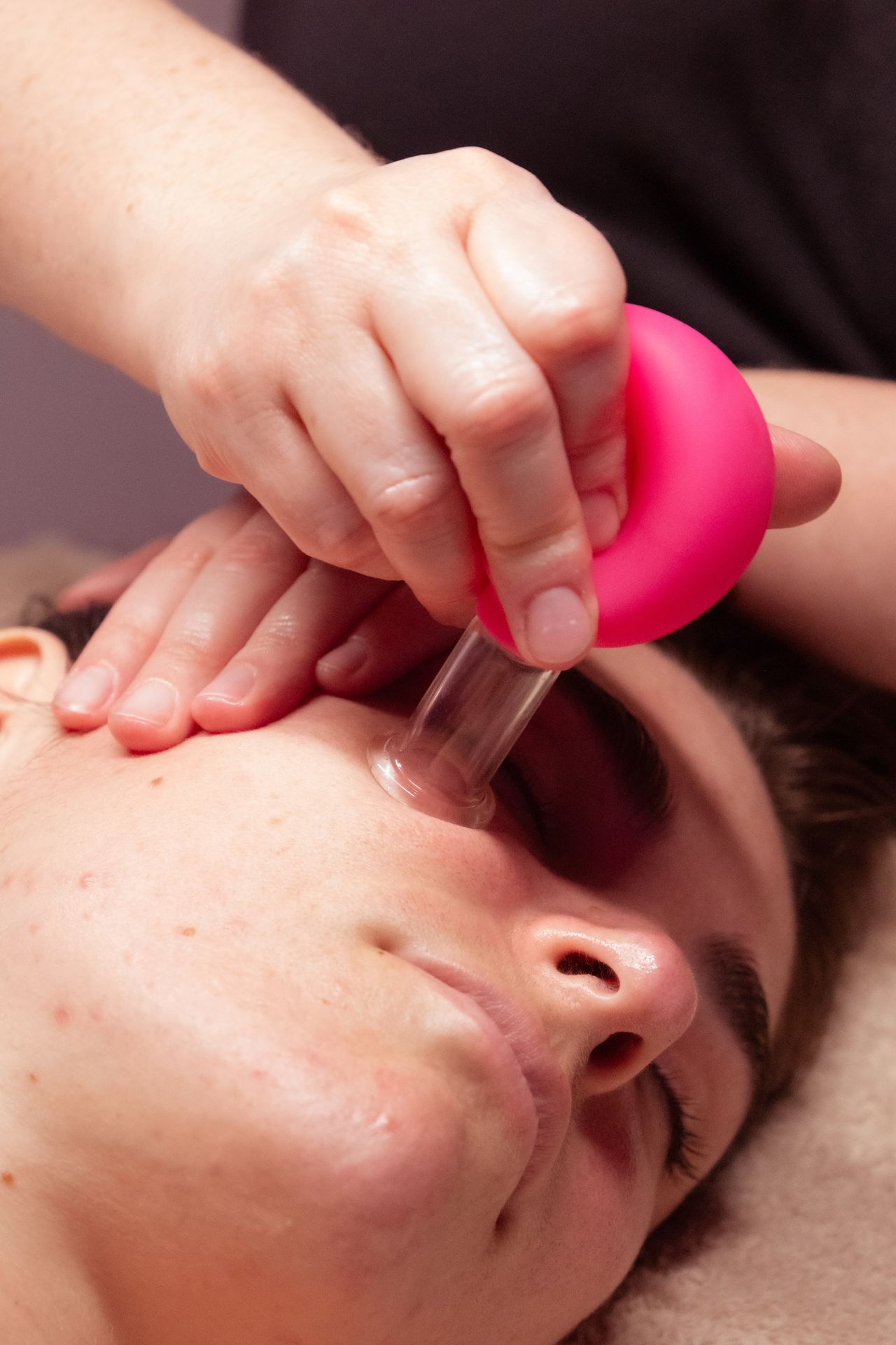 Massage visage repulpant aux ventouses/cupping